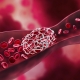 Blood clot blocking a blood vessel and blood stream - 3D illustration